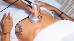 Slimming with Cupping-1600x900-1