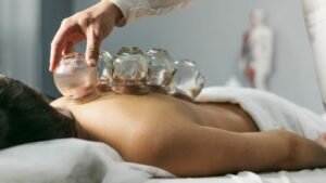 Slimming with Cupping-1600x900-3